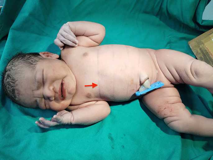 南昌第三代试管龙凤胎费用解析及15万预算评估