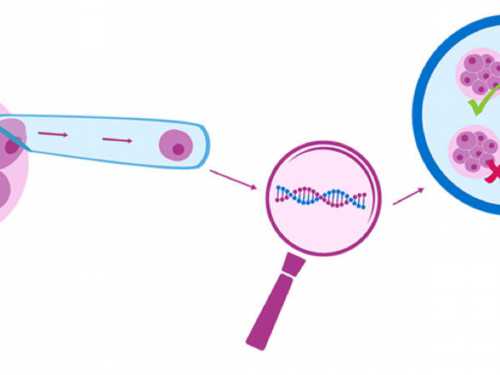 三代试管医院实施试管婴儿手术的全面指南